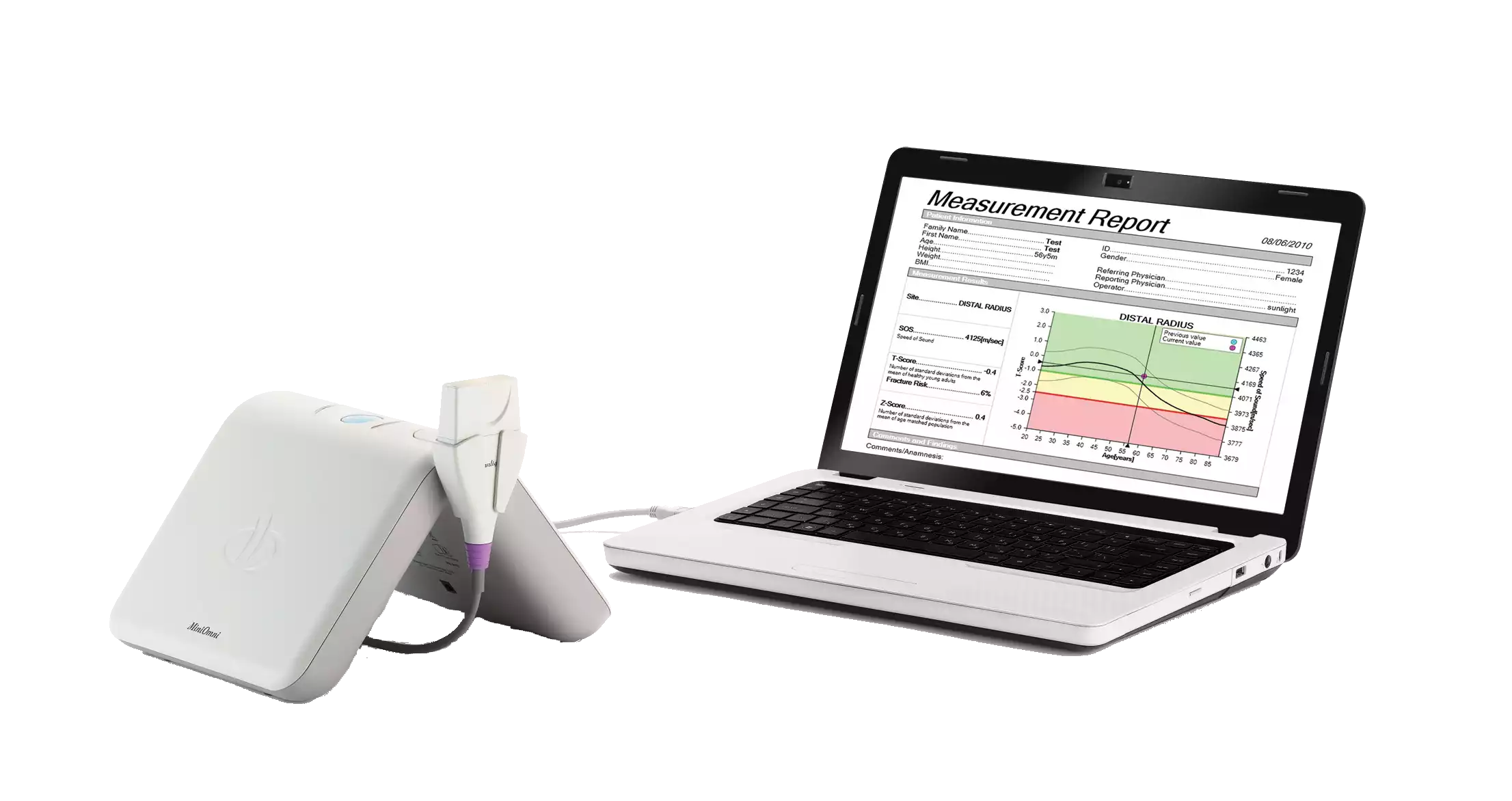 Прибор ультразвуковой диагностический MiniOmni, BeamMed, для диагностики остеопороза