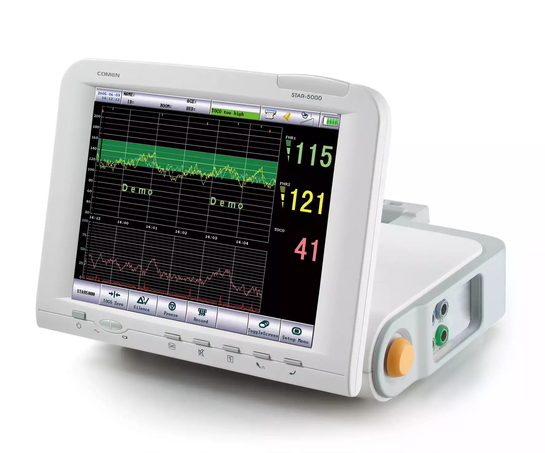 Монитор фетальный STAR 5000
